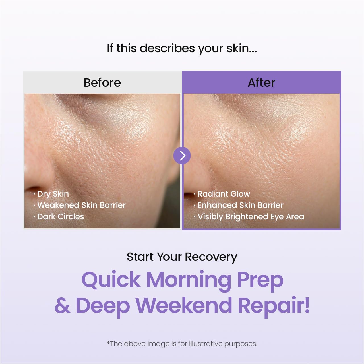 BIODANCE Caviar PDRN Brightening Set: Real Deep Mask & Eye Patches Set, Under Eye Dark Circles & Puffy Eyes, Korean Skincare Routine for Dullness, Glass Skin, Skin Care Gift Set