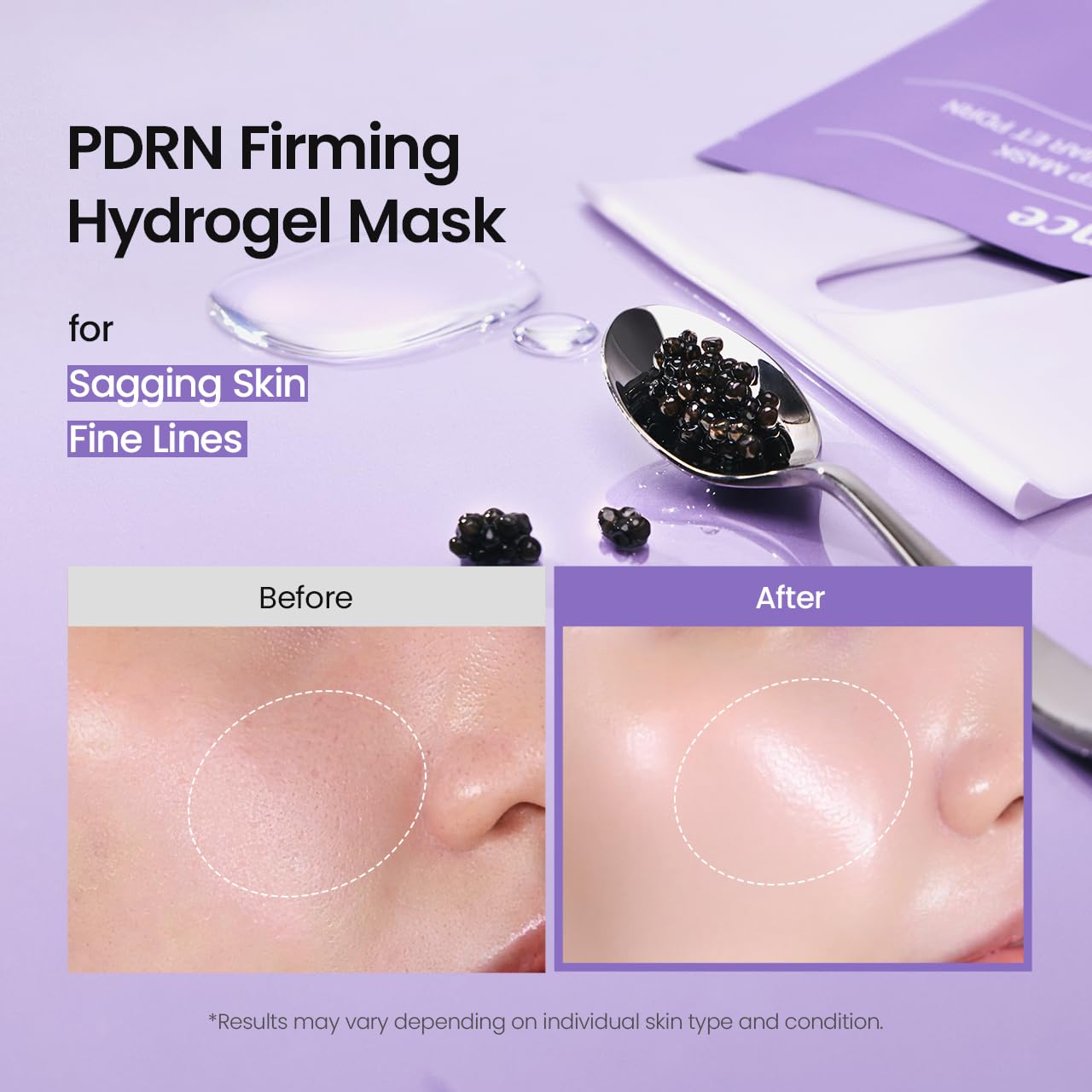 BIODANCE Bio-Collagen Real Deep Mask, Hydrating Overnight Hydrogel Face Mask, Pore Minimizing, Plumping, Elasticity Improvement, Korean Skin Care, Self Care Gifts for Women | 1.19oz(34g) x 16ea